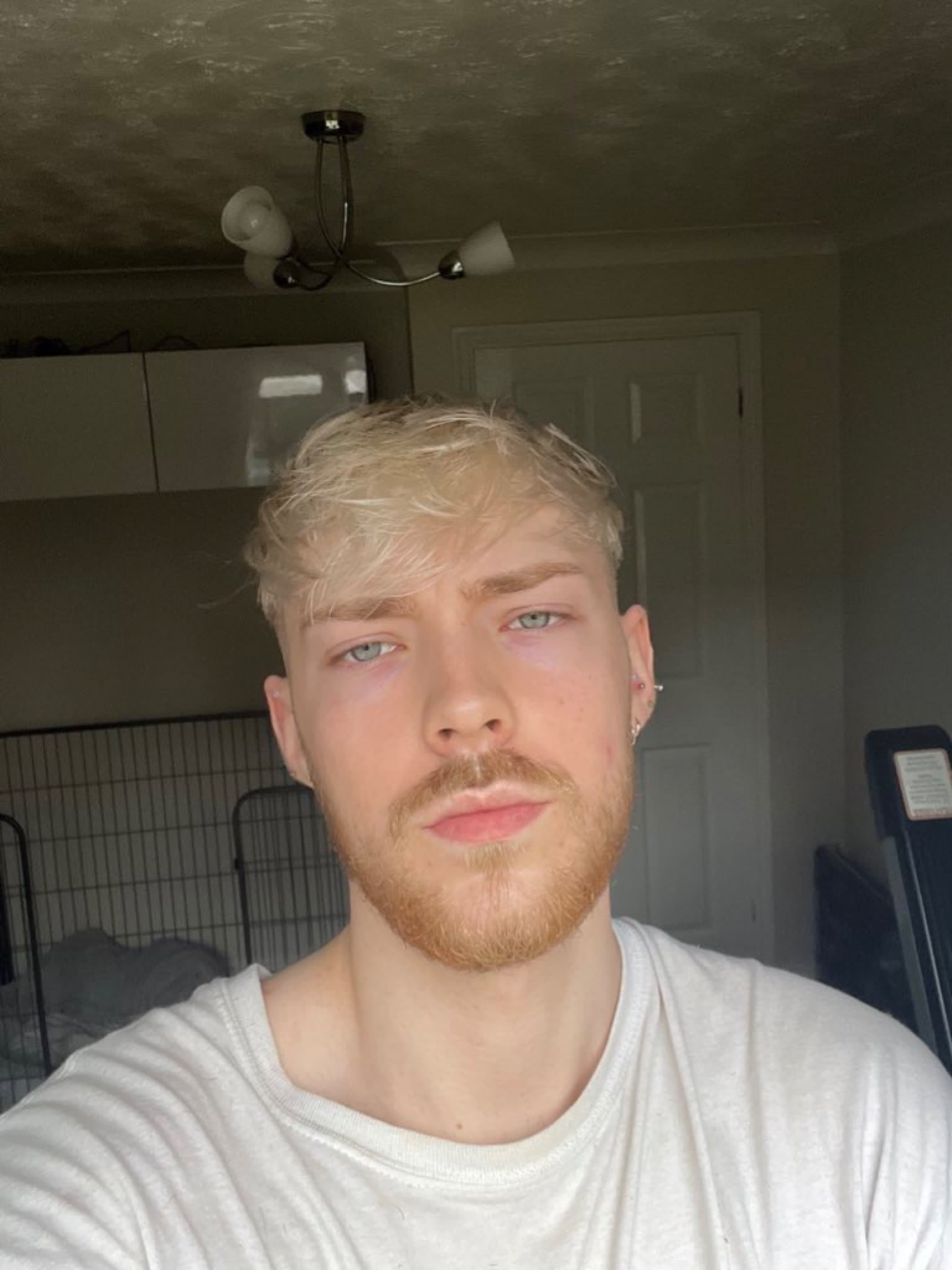 Liam Austin (FREE ACCOUNT)