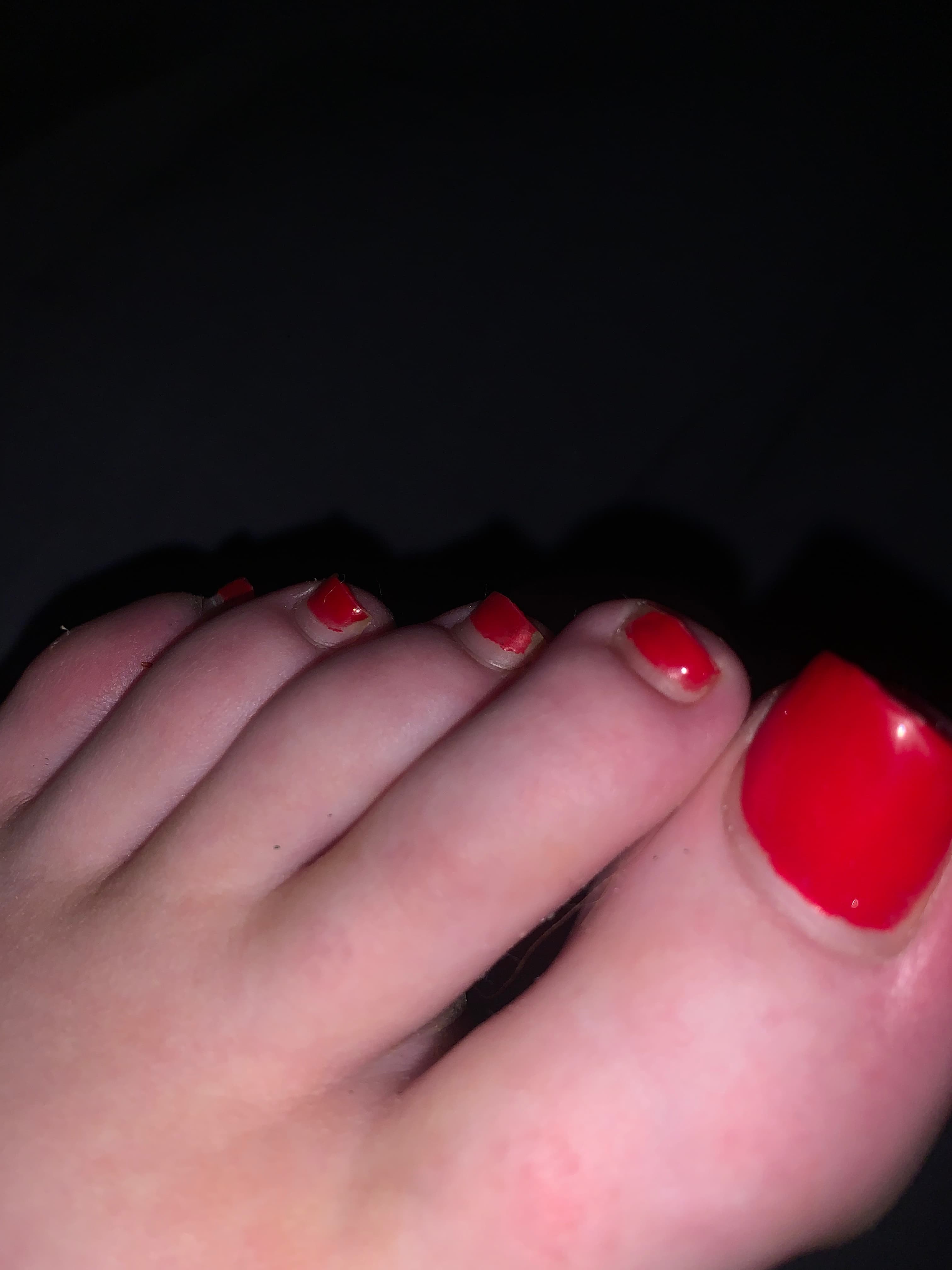 toezzz
